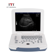 MT Medical Hot Selling Black And White Portable Laptop Ultrasound Machine